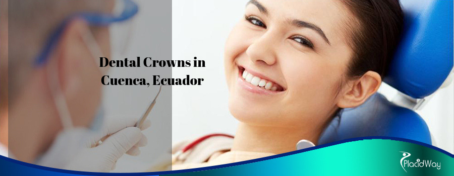 Dental Crowns in Cuenca, Ecuador